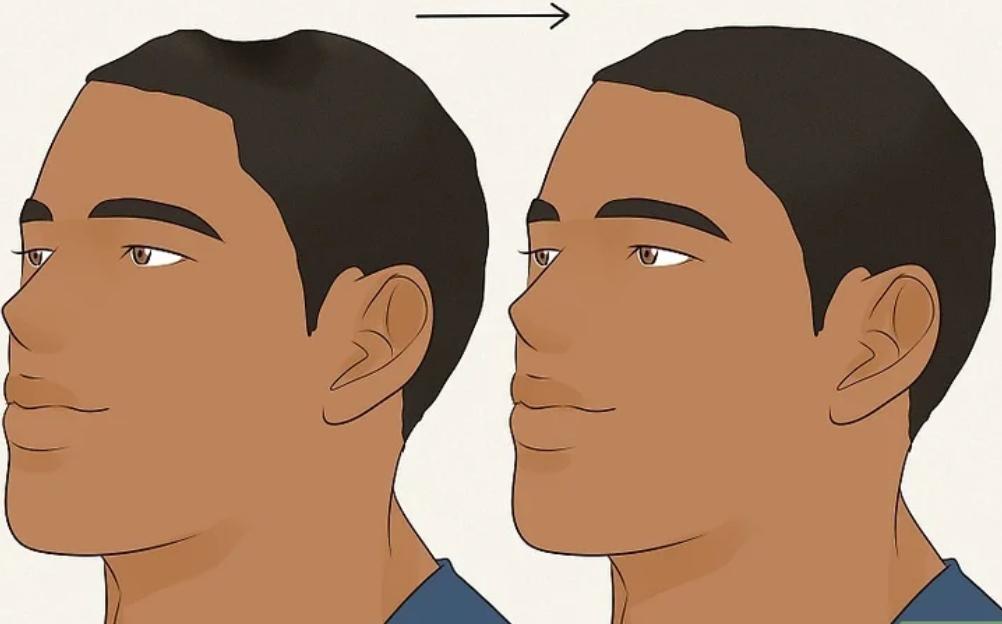 How to Avoid Headphone Dent: Expert Advice
